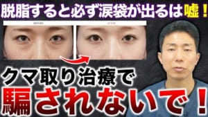 【目の下のクマ取り】目の下の脂肪取り(脱脂)で涙袋ができるのかを解説