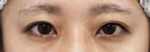 症例写真⑦手術前