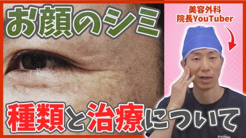 【シミ取り】老人性色素斑、そばかす、ADM、肝斑の見分け方と治療方法