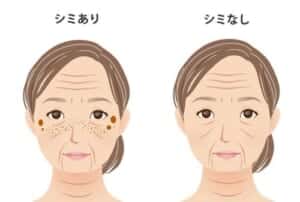 しみありしみなし