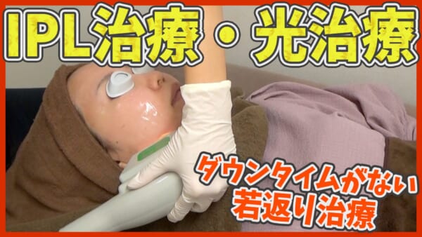 【シミ取り】IPL治療・光治療で肌の印象はどう変わるかを症例写真を使って解説