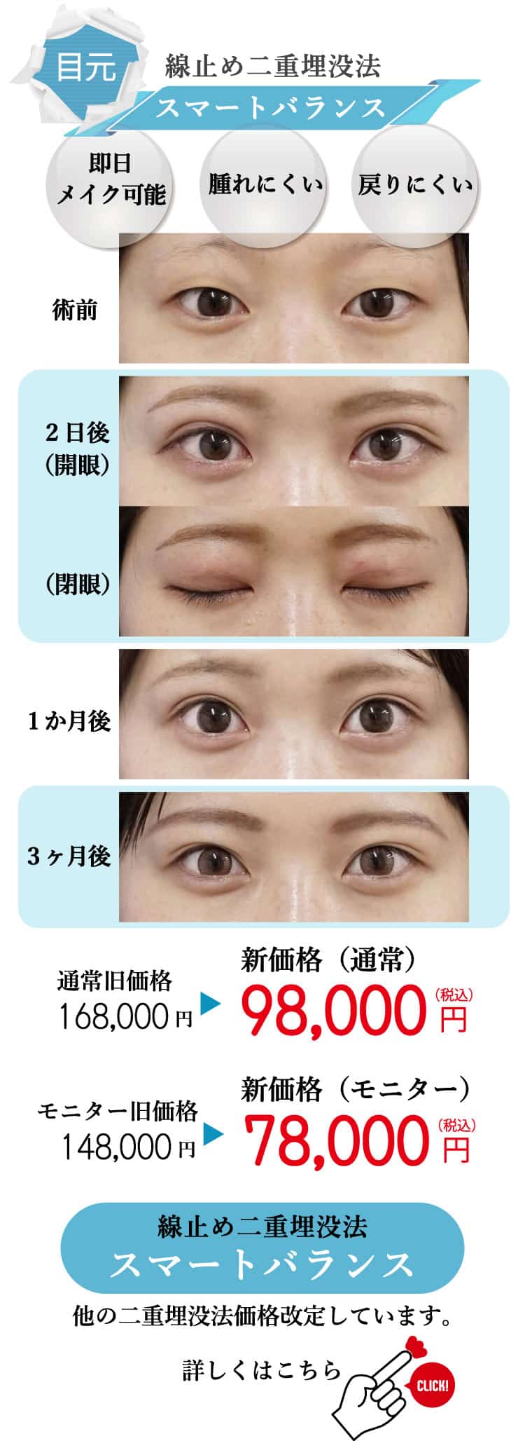 もとび　美容外科クリニック　2025.6価格改定-3