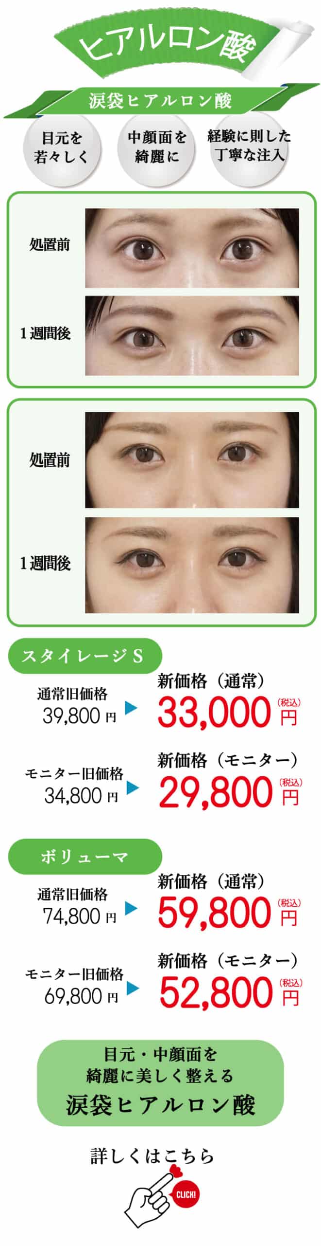 もとび　美容外科クリニック　2025.6価格改定-12