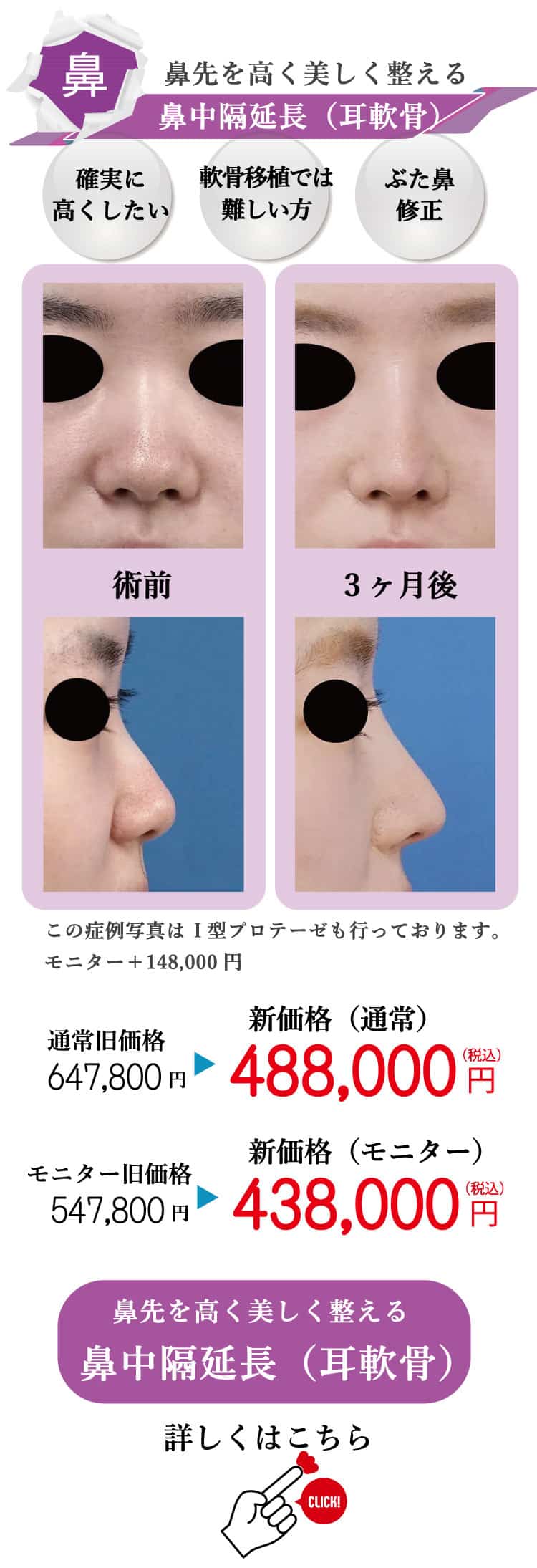 もとび　美容外科クリニック　2025.6価格改定-9