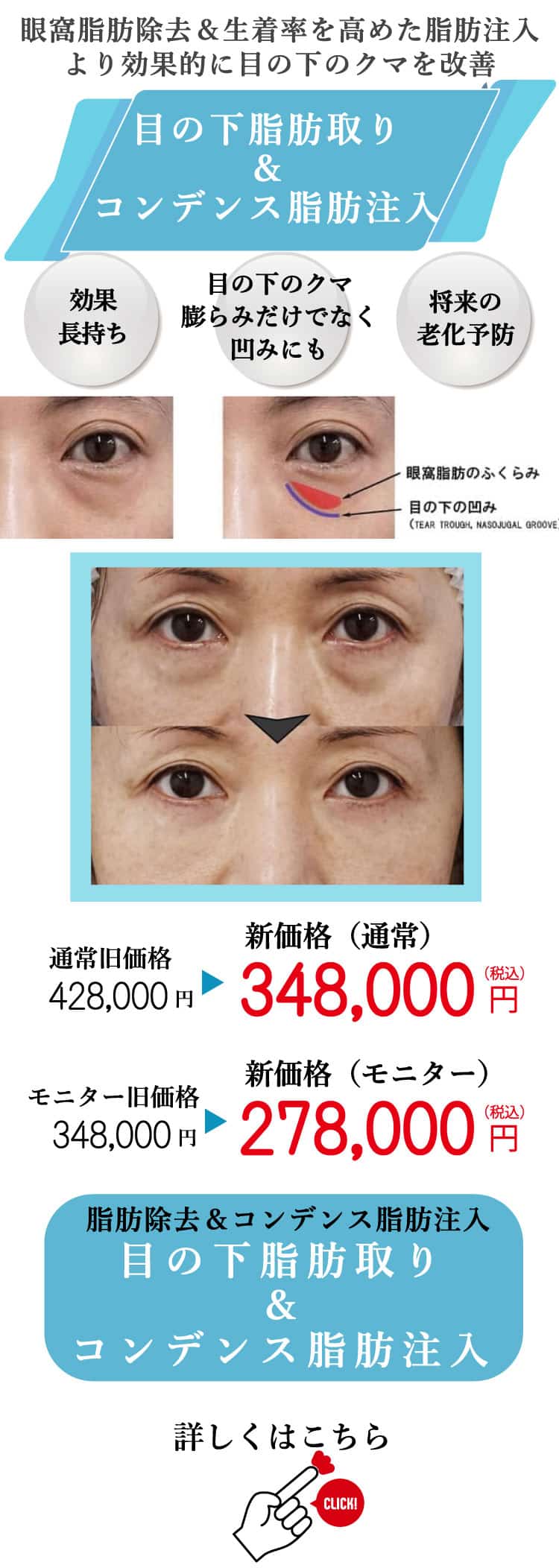 もとび　美容外科クリニック　2025.6価格改定-6