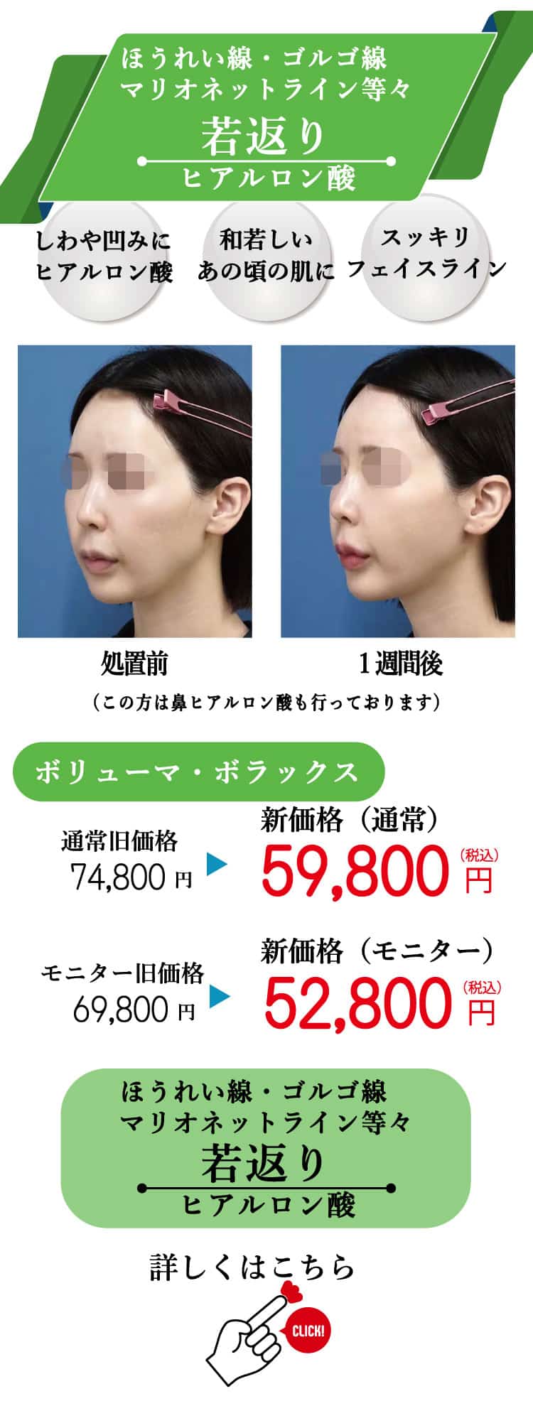 もとび　美容外科クリニック　2025.6価格改定-13
