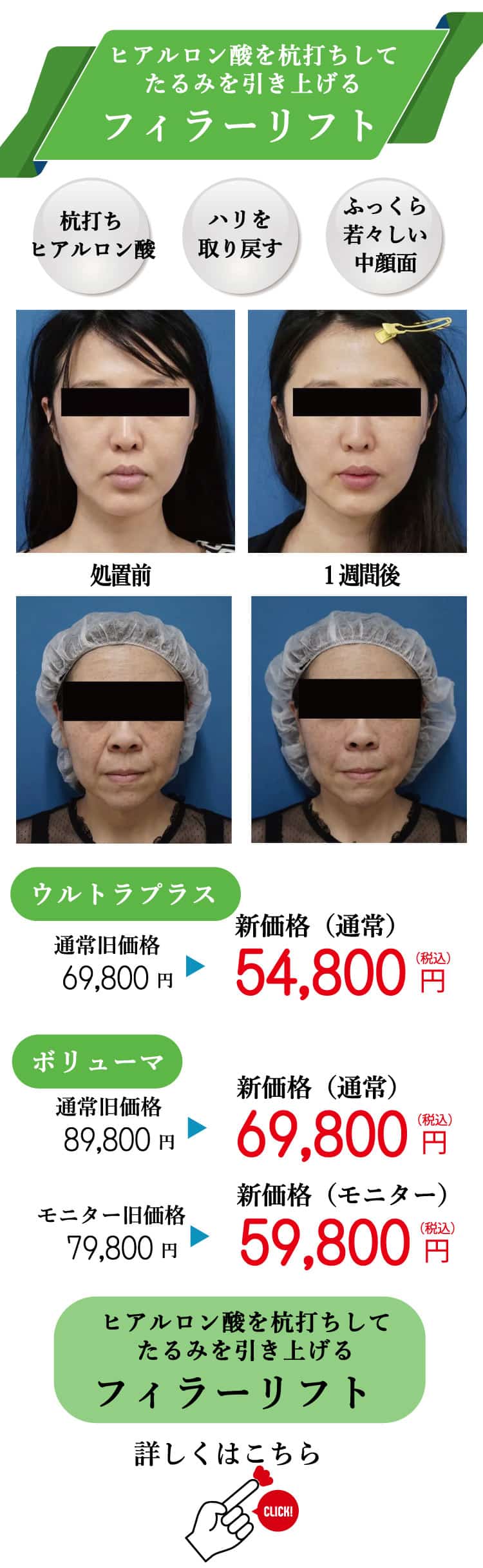 もとび　美容外科クリニック　2025.6価格改定-15