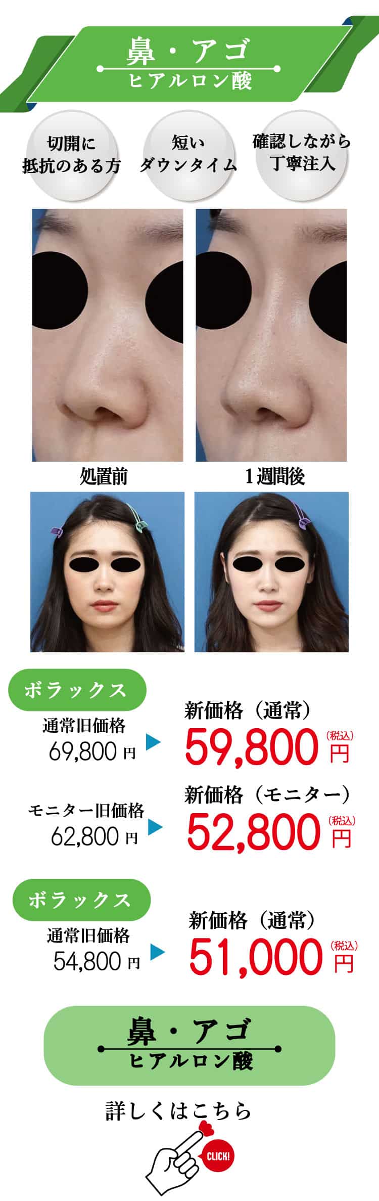 もとび　美容外科クリニック　2025.6価格改定-14