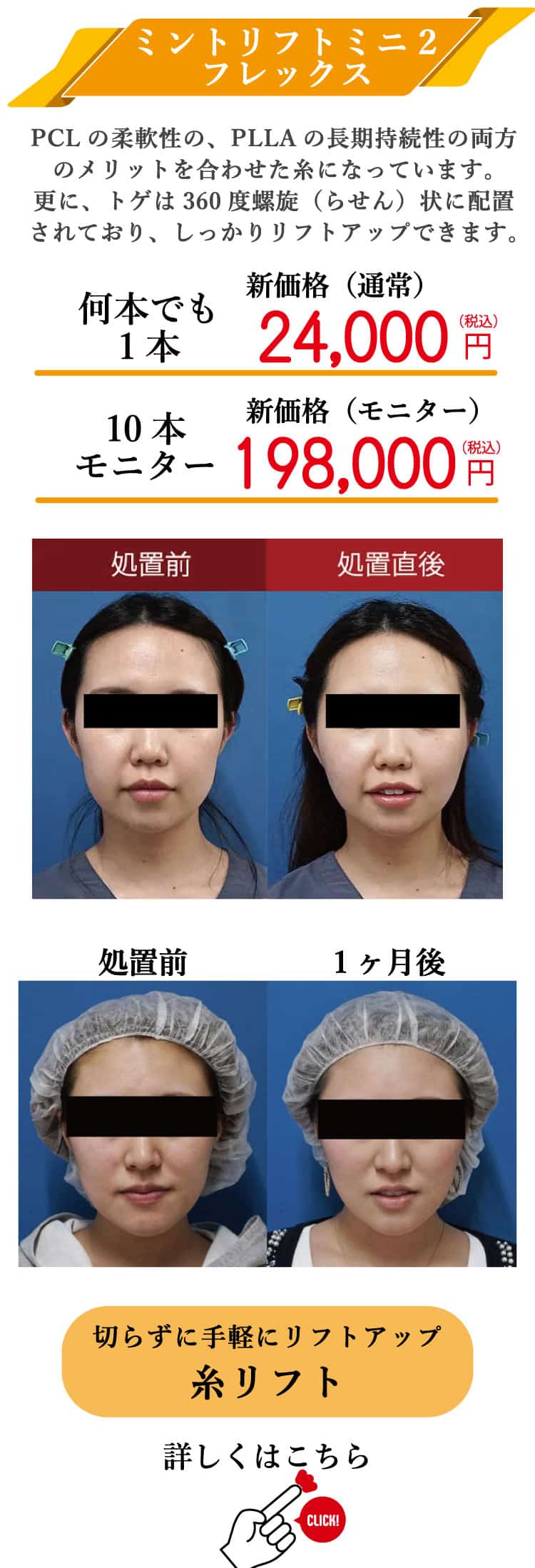 もとび　美容外科クリニック　2025.6価格改定-11-2