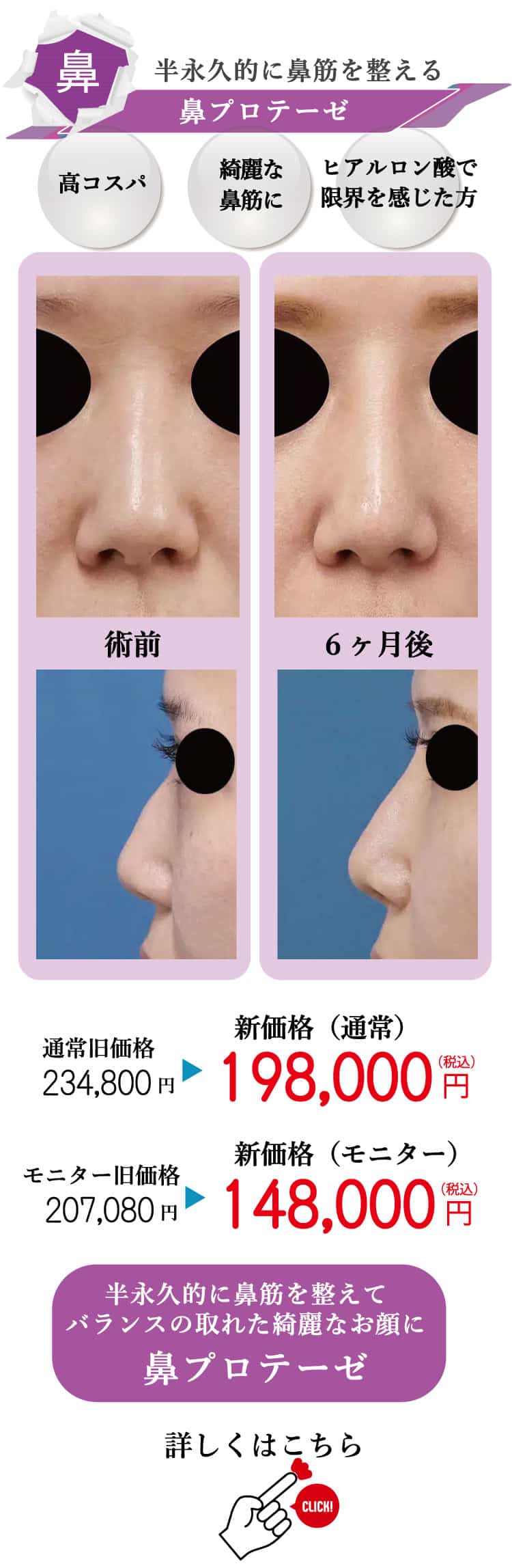 もとび　美容外科クリニック　2025.6価格改定-8