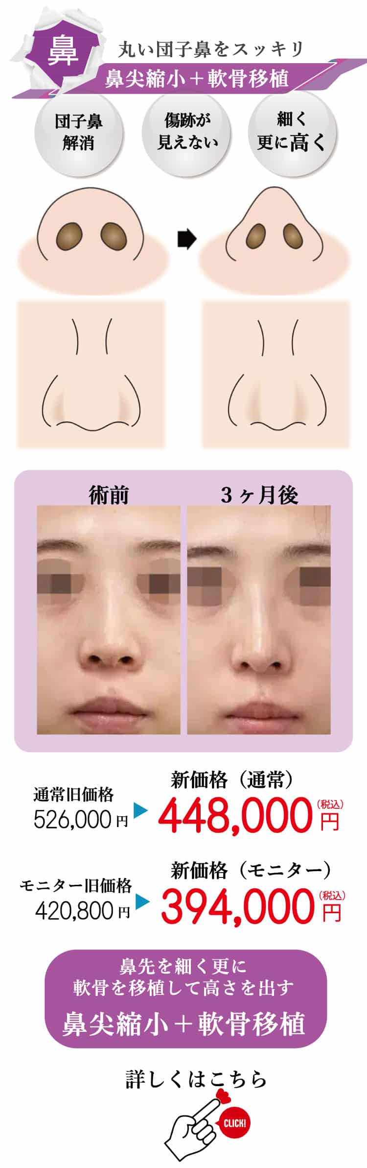もとび　美容外科クリニック　2025.6価格改定-7
