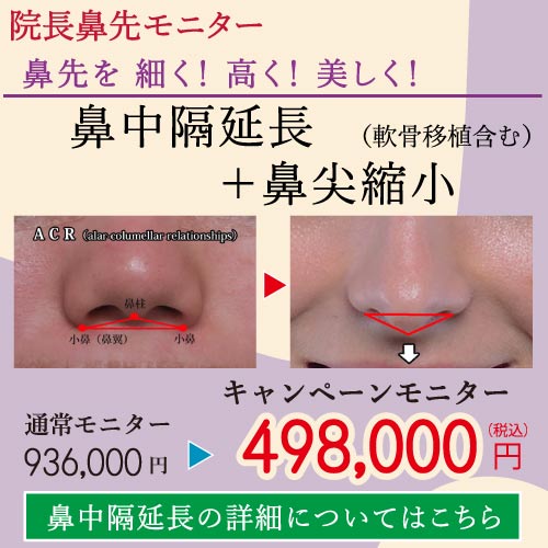 2025.8-美容整形キャンペーン２