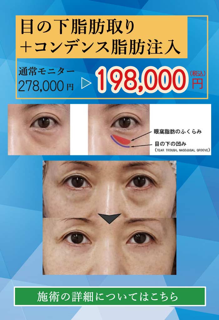 2025.8　美容整形格安モニター募集８