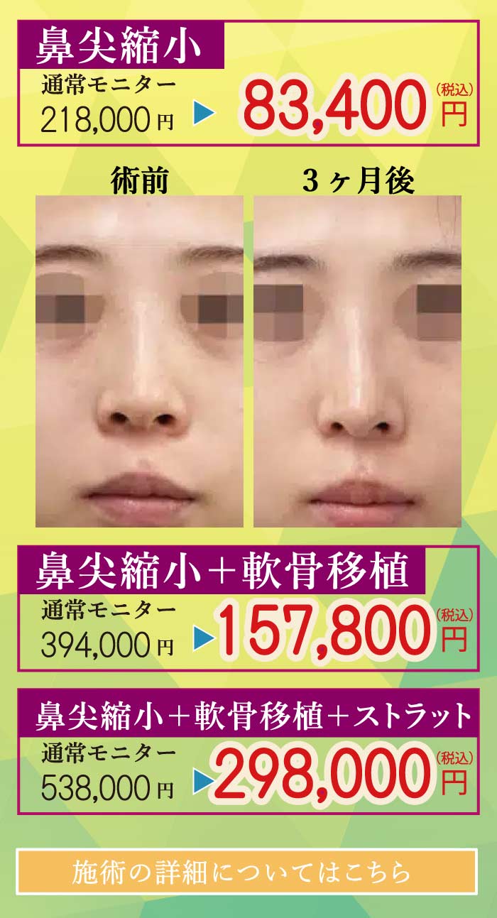2025.8　美容整形格安モニター募集９
