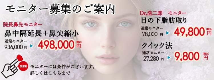 モニター詳細ページ