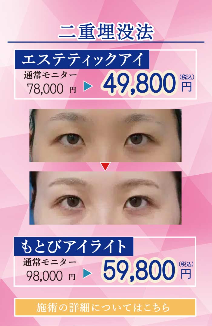 2025.8　美容整形格安モニター募集