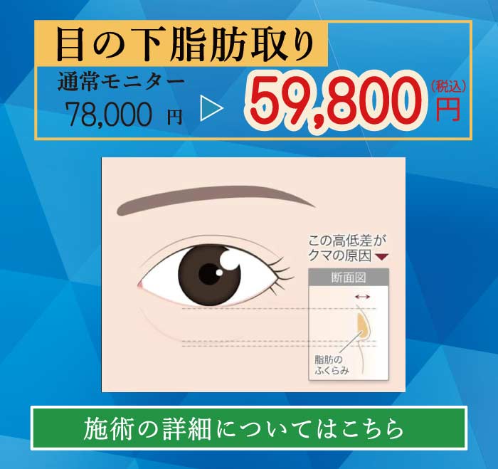 2025.8　美容整形格安モニター募集７