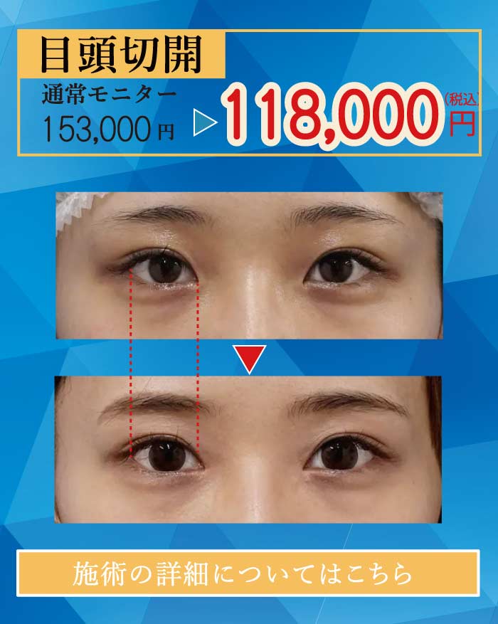 2025.8　美容整形格安モニター募集５