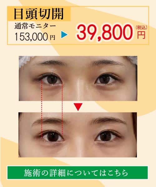 2025.8-美容整形キャンペーン６