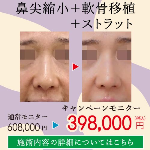 2025.8-美容整形キャンペーン３