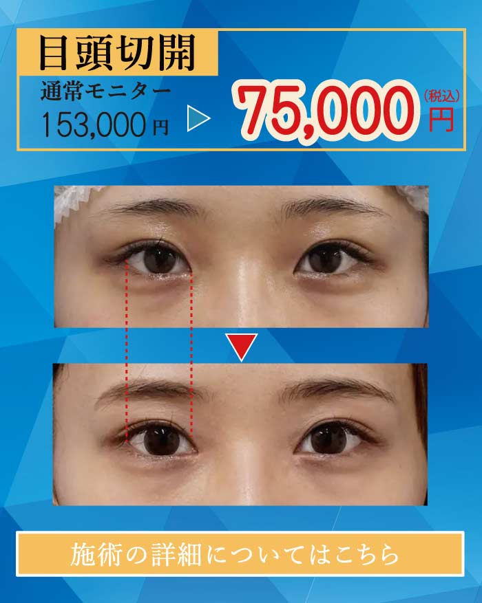 2025.8　美容整形格安モニター募集５