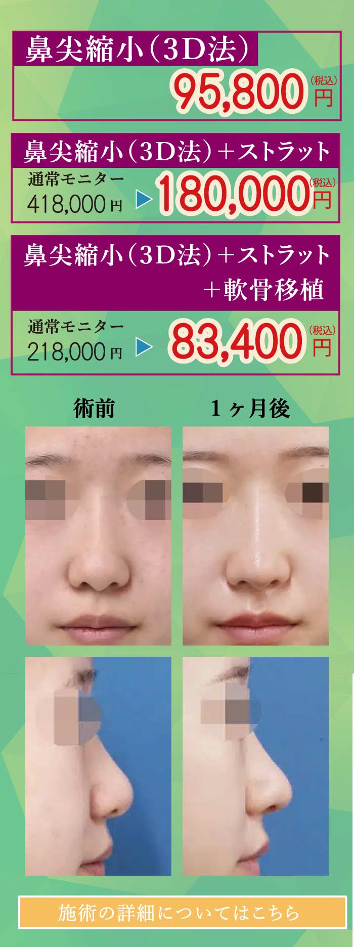 2025.8　美容整形格安モニター募集１０