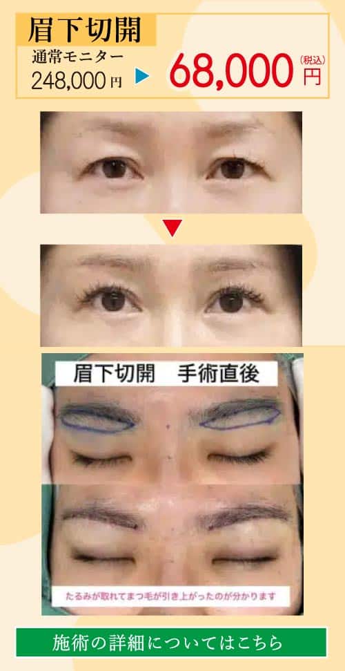 2025.8-美容整形キャンペーン８