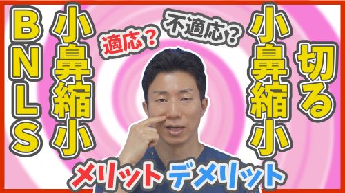 小鼻縮小BNLSと切らない小鼻縮小の適応・不適応やメリット・デメリットを比較解説