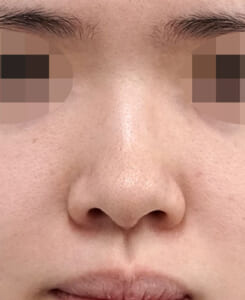 正面
