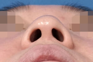 下から
