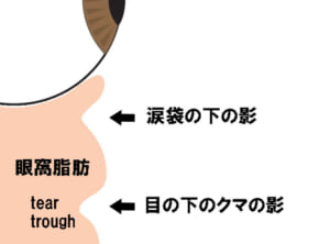 断面図解説1