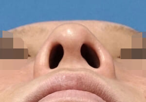 下から