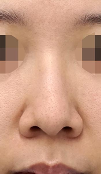 のBefore写真