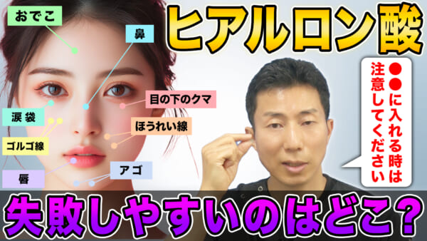 ヒアルロン酸治療で不自然になりやすいパーツ ベスト3　