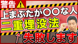 二重埋没法で二重がつきにくい人の特徴｜眼瞼下垂・くぼみ目・厚ぼったい人は必ず見て