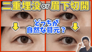 二重整形と眉下切開について