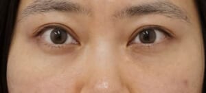 DSC05393正面10ヶ月後