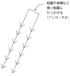 糸リフト　アンカータイプ　糸力図