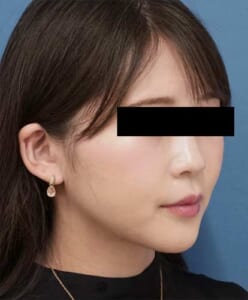 DSC01195右ナナメ