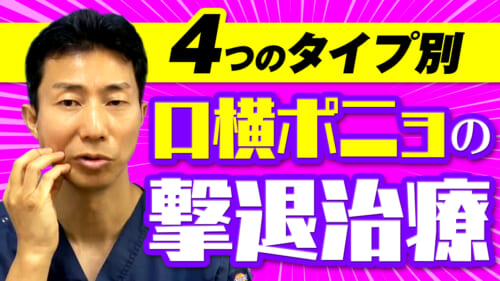 【4つのタイプ別】口横のポニョを撃退する方法を徹底解説