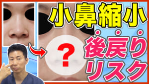 【鼻整形】小鼻縮小の術後の後戻りリスクを防ぐ方法を解説