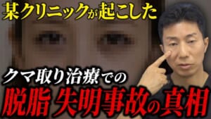 目の下のクマの脱脂治療で失明？美容施術の失明リスクについて解説
