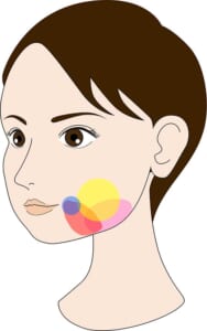 口横ポニョ原因