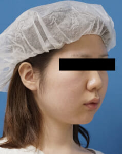 DSC02084右ナナメ