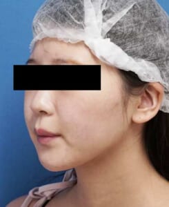 DSC00375左ナナメ