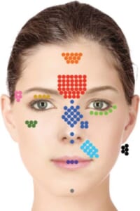 失明に至った注入部位