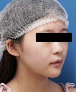 DSC00373右ナナメ