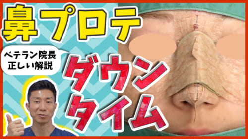 【鼻整形】鼻にシリコンプロテーゼを入れたらダウンタイムはどれくらいかかる？