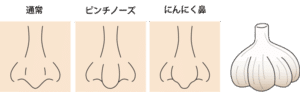 にんにく鼻