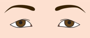 たるみ目
